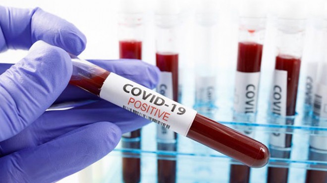 İtalyan bilim insanlarından kritik koronavirüs raporu