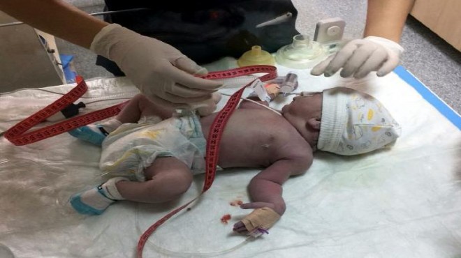İzmirli 16 günlük Ömer bebek...Yaşam savaşı veriyor