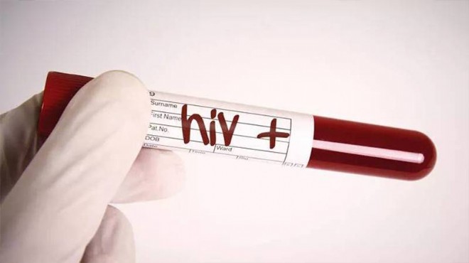 Kızılay dan verilen kanda HIV çıktı!