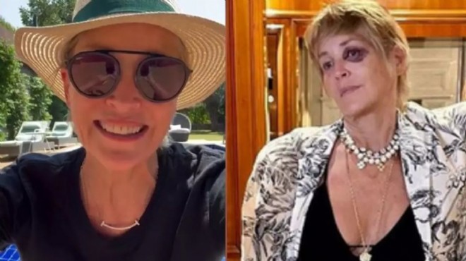 Sharon Stone, Bodrum da kaza geçirdi